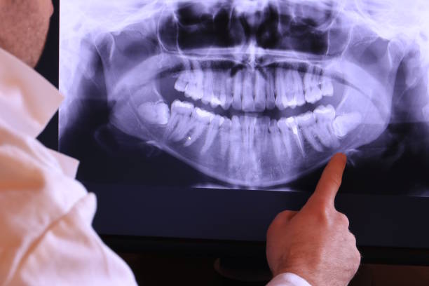 Best Emergency Tooth Extraction in La Marque, TX